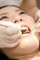 歯の治療を受ける女性患者
