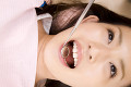 歯科診療を受ける女性