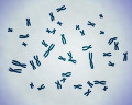 030: 染色体の電子顕微鏡イメージ